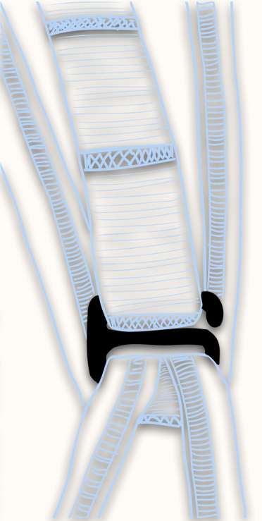 Tira Ancha Ajustable - 4 Posiciones